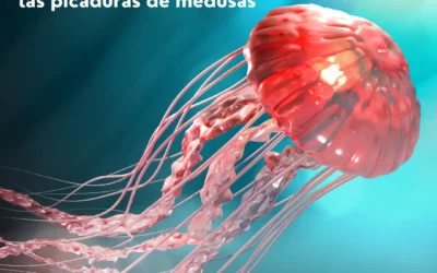 Manejo de las picaduras de medusa: Guía para abordarlas